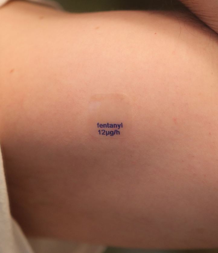 What does fentanyl look like? and what does a fentanyl patch look like?  It comes as a thin patch that is applied directly to the skin. It's relatively small and clear and comes in individually wrapped packets. The fentanyl skin patch is used to treat severe pain, including acute pain following surgery.