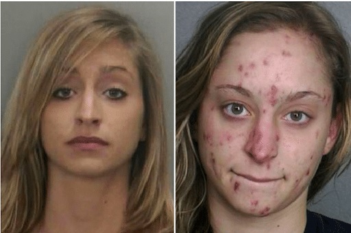 Meth before and after photos shows devastating consequences for its users. It is highly addictive and presents a significant risk to the community. Meth has the most significant link with the violence of any narcotic in the US. Image Source/For more before and after pictures of meth addicts and crystal meth before and after pics, visit www.dea.gov.