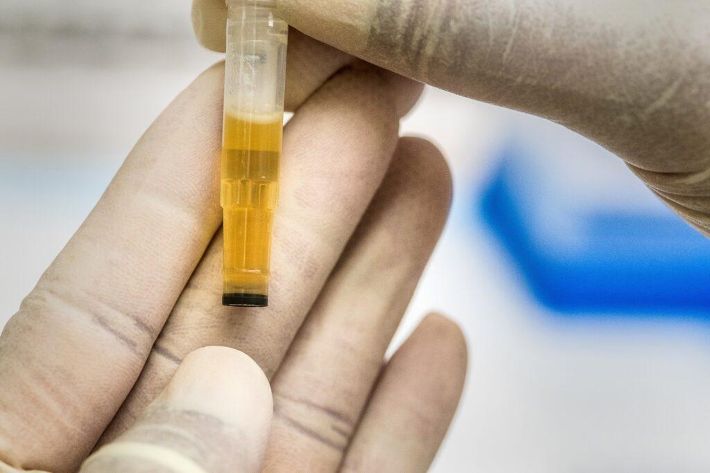 Only 40 minutes after intake, buprenorphine can be found in urine testing.