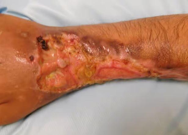It is crucial to emphasize that the krokodil drug is extremely hazardous and illegal, and its production and use pose significant risks to individuals' health and well-being.